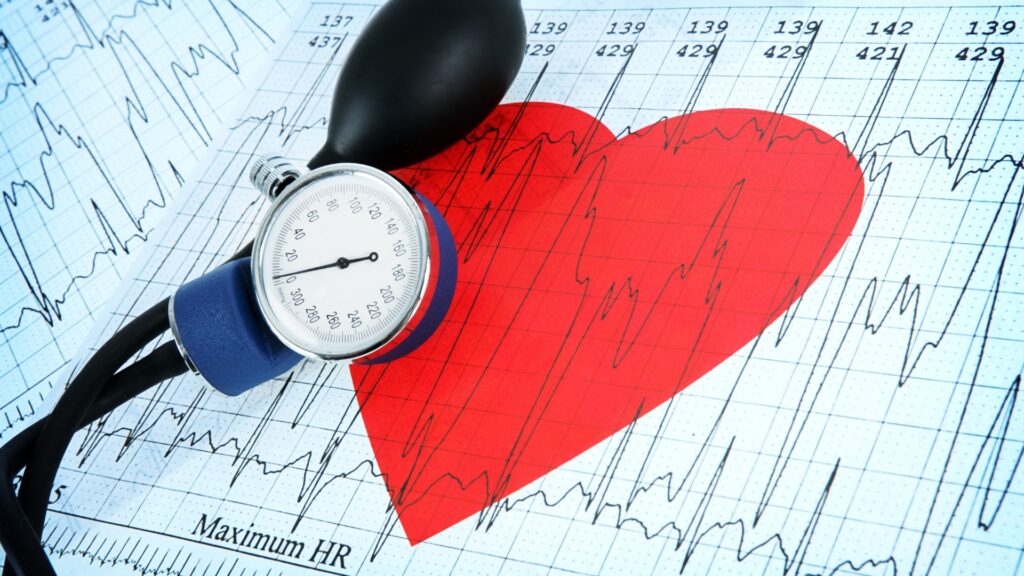 Blutdruckmessgerät mit Manometer auf einem roten Papierherz und EKG-Ausdrucken